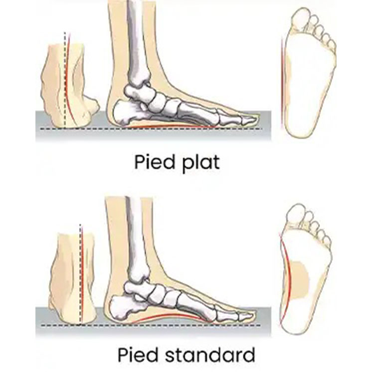 pied-plat