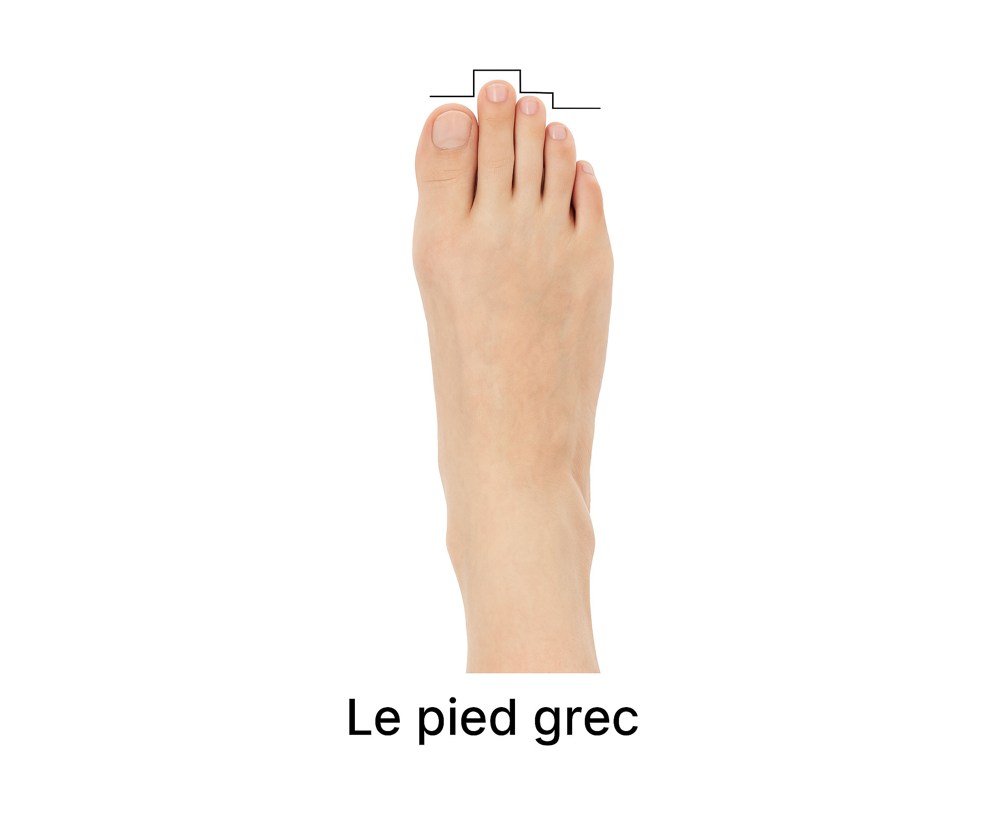 un-pied-grec